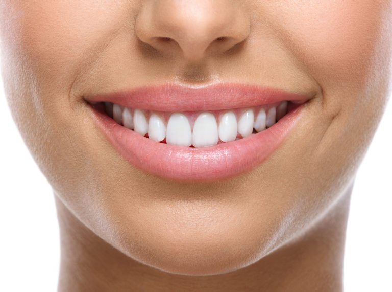 woman's nice white teeth smiling